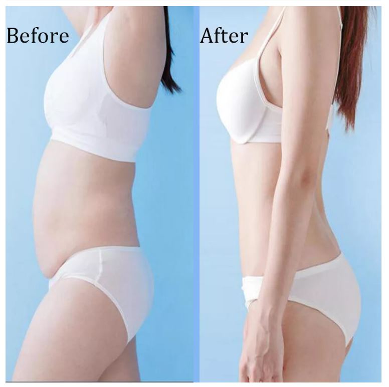 80k RF Fat Lipo Cavitation And Vacuum Machine Weight Loss Cellulite Remover